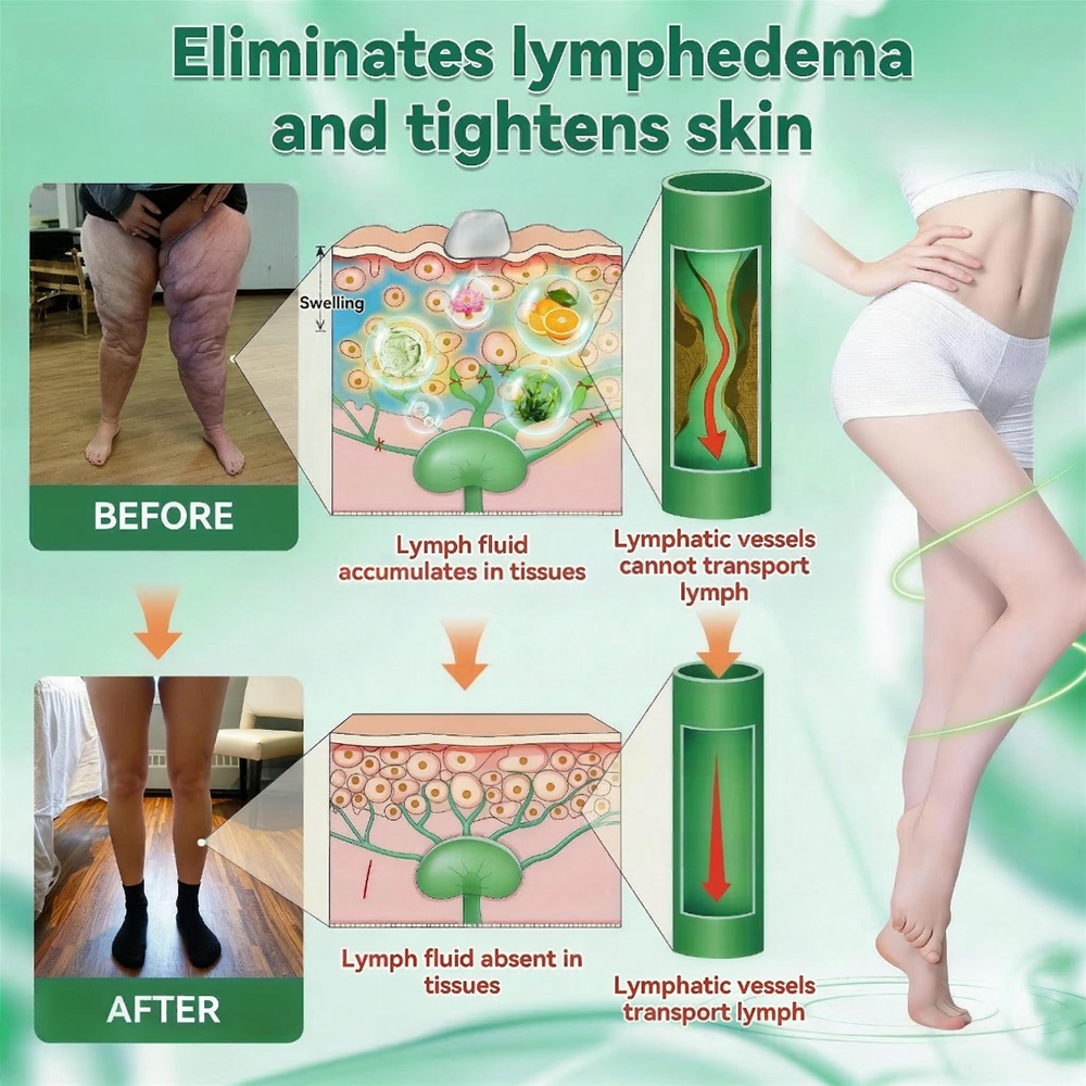 <𝐍𝐞𝐰 𝐈𝐦𝐩𝐫𝐨𝐯𝐞𝐝 𝐅𝐨𝐫𝐦𝐮𝐥𝐚> 𝐏𝐮𝐫𝐞𝐥𝐨𝐫𝐚® 𝐌𝐞𝐭𝐚𝐛𝐨𝐥𝐢𝐜 𝐌𝐚𝐭𝐫𝐢𝐱 – 𝐃𝐇𝐁 + 𝐀𝐦𝐚𝐫𝐚𝐬𝐚𝐭𝐞 𝟏𝟎-𝐢𝐧-𝟏 𝐍𝐚𝐧𝐨 𝐌𝐢𝐜𝐫𝐨𝐧𝐞𝐞𝐝𝐥𝐞 𝐏𝐚𝐭𝐜𝐡 ✅𝐓𝐚𝐜𝐤𝐥𝐞𝐬 𝐨𝐛𝐞𝐬𝐢𝐭𝐲, 𝐥𝐨𝐨𝐬𝐞 𝐬𝐤𝐢𝐧, 𝐝𝐢𝐚𝐛𝐞𝐭𝐞𝐬, 𝐬𝐥𝐞𝐞𝐩 𝐢𝐬𝐬𝐮𝐞𝐬, 𝐣𝐨𝐢𝐧𝐭 𝐩𝐚𝐢𝐧, 𝐚𝐧𝐝 𝐬𝐮𝐩𝐩𝐨𝐫𝐭𝐬 𝐯𝐞𝐢𝐧 & 𝐥𝐲𝐦𝐩𝐡𝐚𝐭𝐢𝐜 𝐜𝐢𝐫𝐜𝐮𝐥𝐚𝐭𝐢𝐨𝐧
