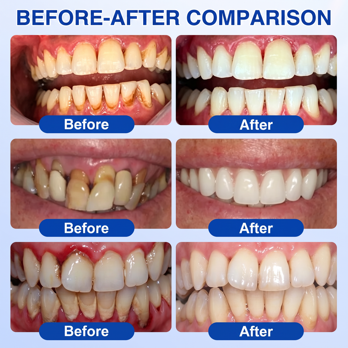 🇬🇧𝐏𝐮𝐫𝐞𝐥𝐨𝐫𝐚® 🦷  periodontal repair gel 🧑‍⚕️