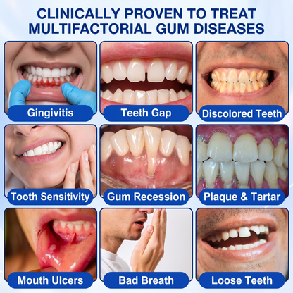 🇬🇧𝐏𝐮𝐫𝐞𝐥𝐨𝐫𝐚® 🦷  periodontal repair gel 🧑‍⚕️