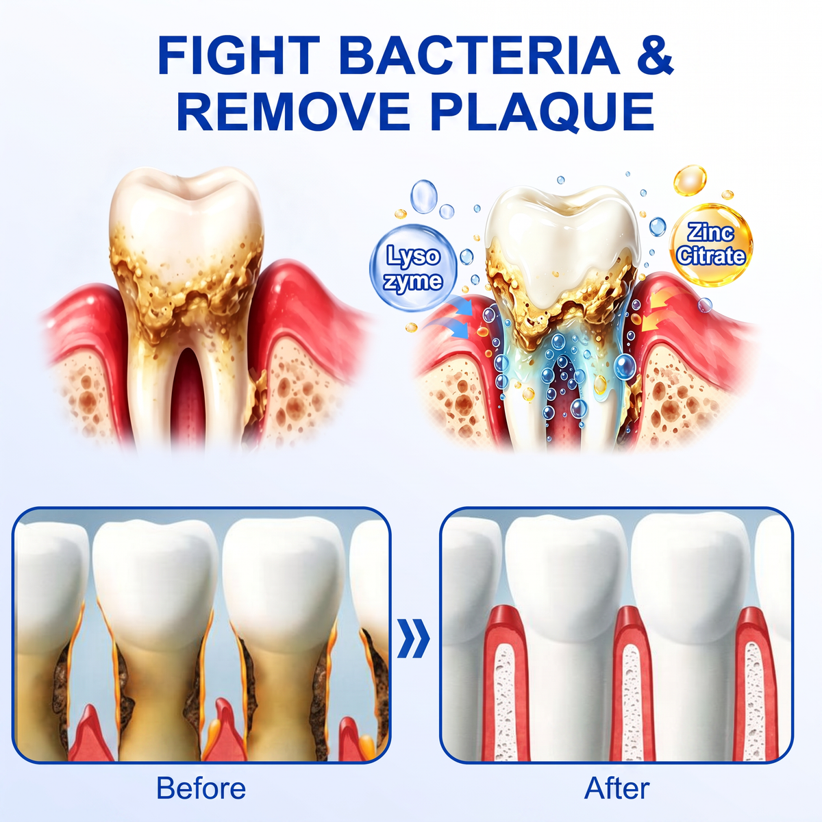 🇬🇧𝐏𝐮𝐫𝐞𝐥𝐨𝐫𝐚® 🦷  periodontal repair gel 🧑‍⚕️