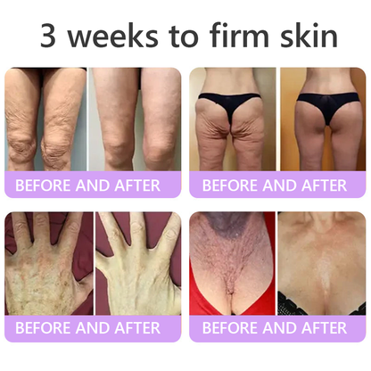 𝐏𝐮𝐫𝐞𝐥𝐨𝐫𝐚® ❤️PDRN Multi-Peptide Massaging Body Roller Cream- Anti-aging, Hydrating, Skin Firming & Lifting, Skin Repair, Even Tone, Acne and Dark Spot Treatment, Wart and Mole Removal, and Psoriasis Relief.