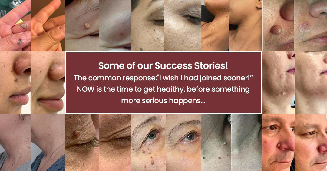 🏥𝐏𝐮𝐫𝐞𝐥𝐨𝐫𝐚®2-in-1 Microneedle & Hydrocolloid Patch🍀| Removes Raised Moles, Acne, Flat Warts & Skin Tags | Helps Improve Wrinkles, Scars & Blemishes | Invisible Patches for Face & Body