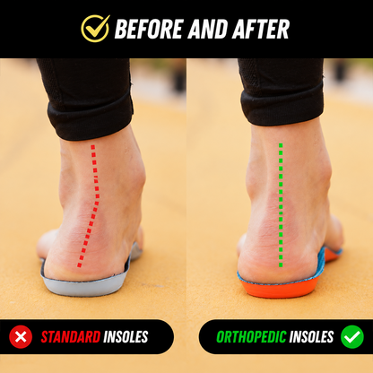 👣 Orthopedic Arch Support Insoles – All-Day Comfort for Tired, Aching Feet